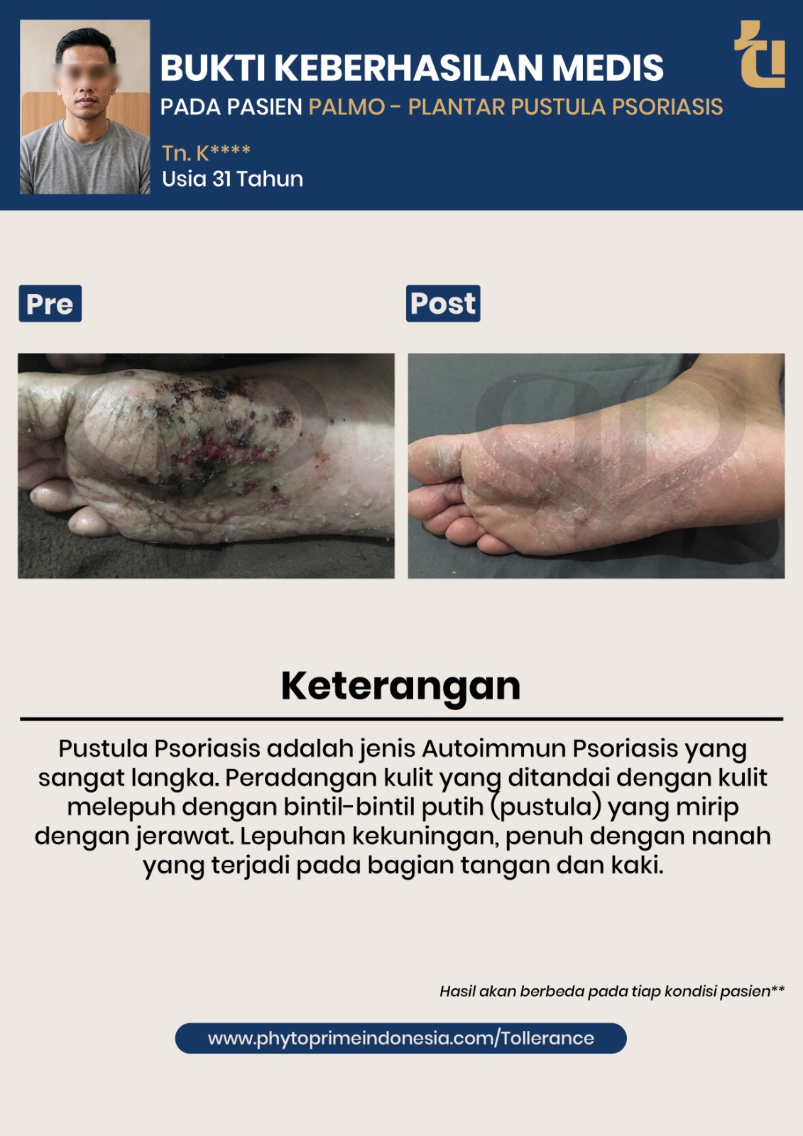 Bukti keberhasilan medis pasien kedua
